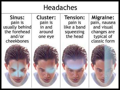 soorten hoofdpijn